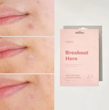 Carica l'immagine nel visualizzatore di Gallery, Breakout Hero